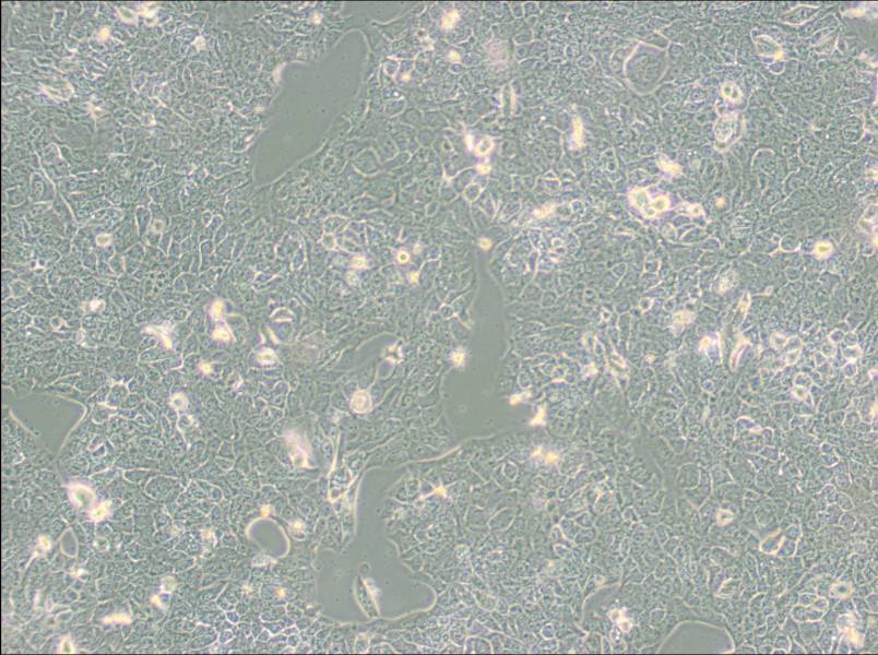 NCI-H2228 [H2228; H-2228] Cell Complete Medium - 2