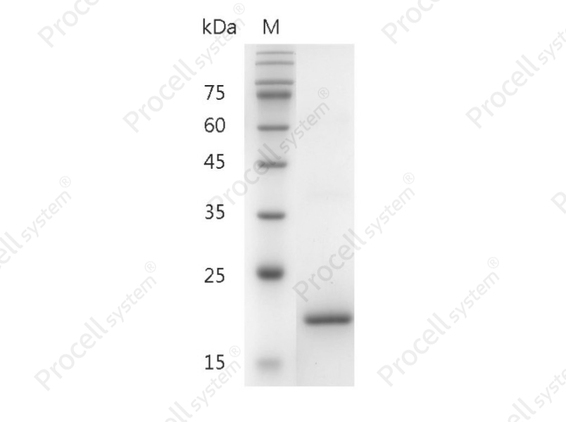 G-CSF/CSF-3/MGI-1G, Human, Recombinant