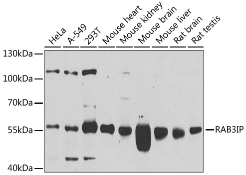 Western blot analysis of extracts of various cell lines using RAB3IP Polyclonal Antibody at 1:1000 dilution.