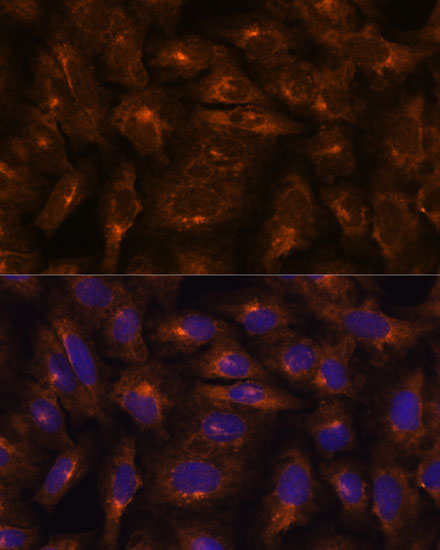 Immunofluorescence analysis of U-2 OS cells using IFITM3 Polyclonal Antibody at dilution of  1:100. Blue: DAPI for nuclear staining.