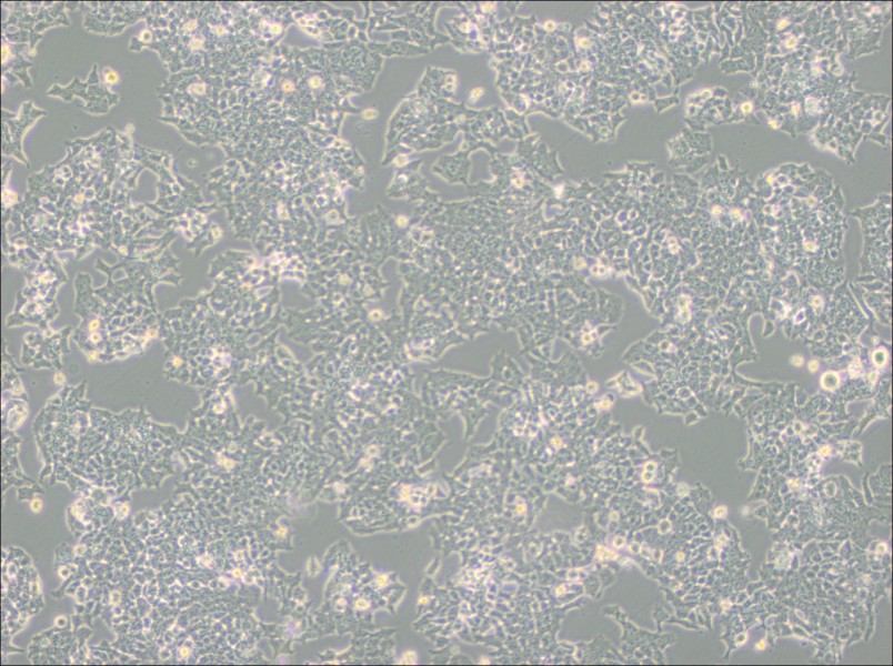 NCI-H520 Cell Complete Medium - 2