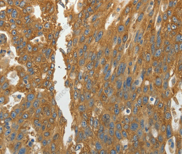 RPLP0 Polyclonal Antibody - 3