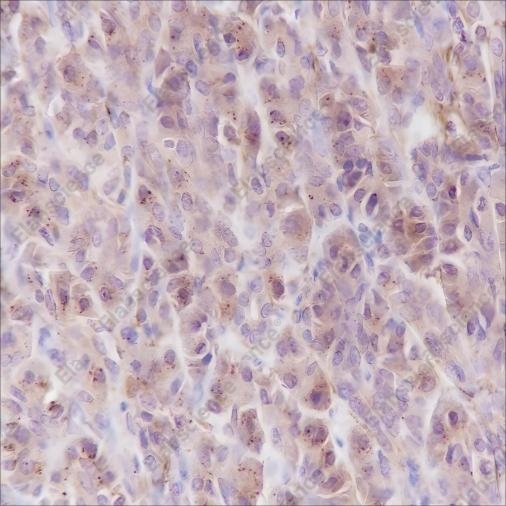 Recombinant PI3 Kinase p85 alpha Monoclonal Antibody - 2