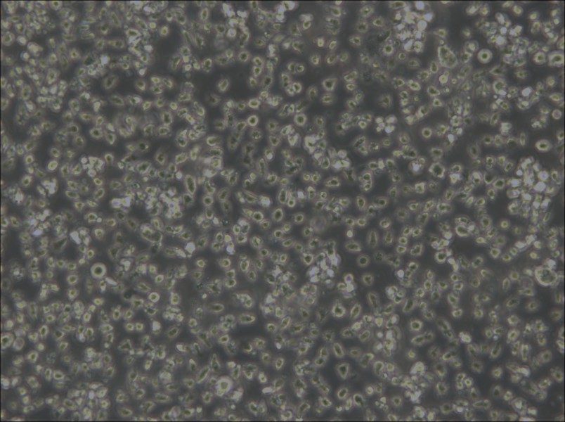 MEC-1 Cell Complete Medium - small - 4