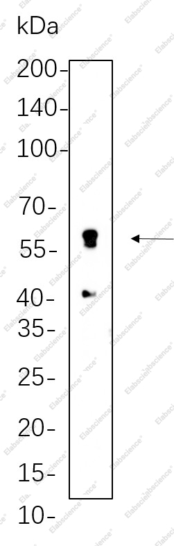 Recombinant Perilipin-1 Monoclonal Antibody - 1