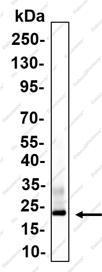 Recombinant GPX3 Monoclonal Antibody - 1