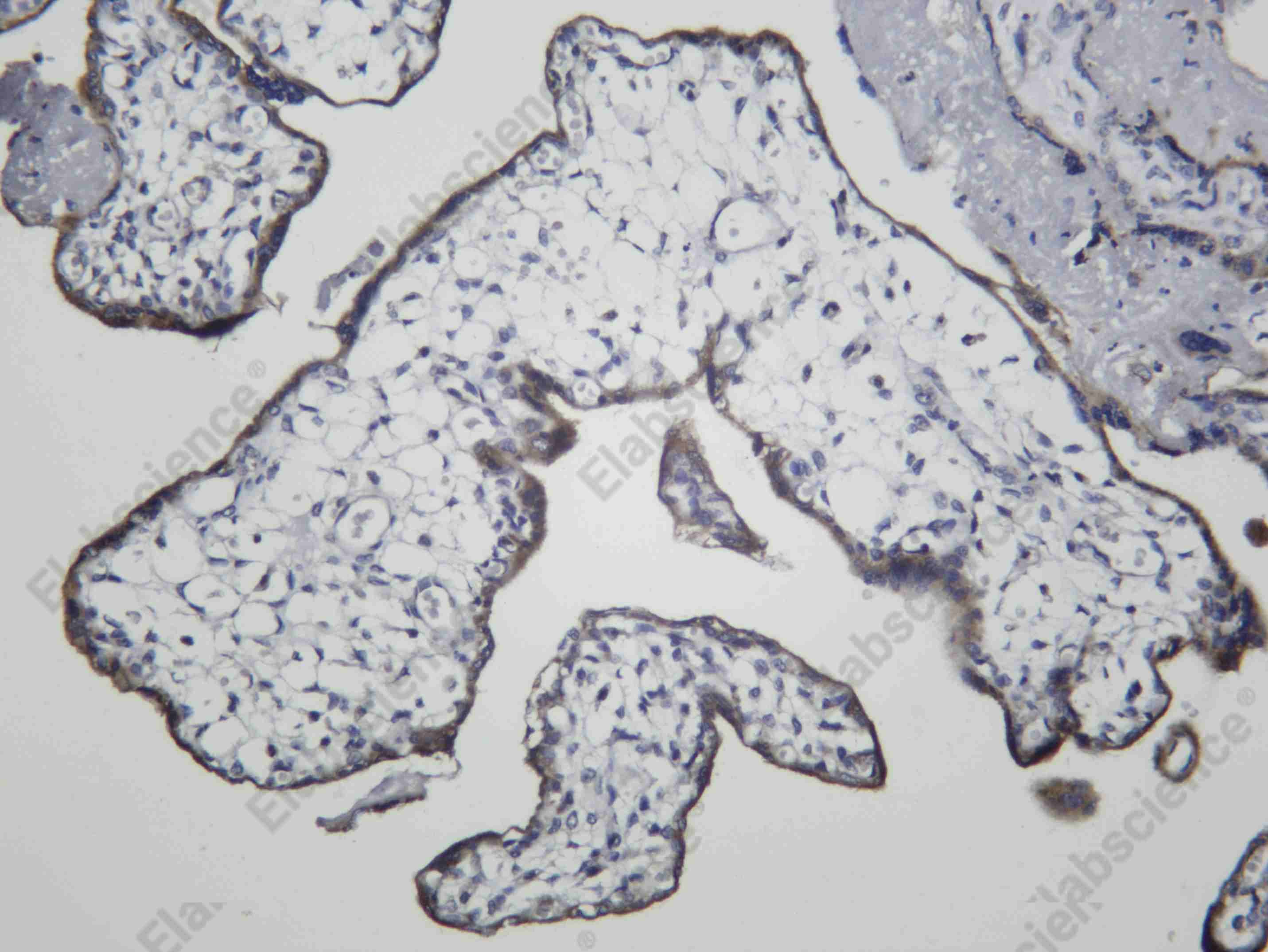 Recombinant FURIN Monoclonal Antibody - 1