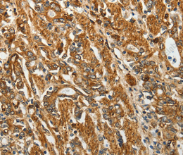 RPLP0 Polyclonal Antibody - 2