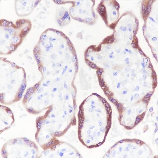 Recombinant hCG beta Monoclonal Antibody-searchlist-1