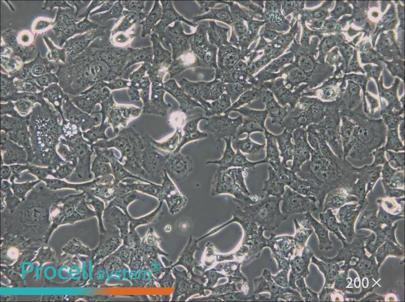 HCC1954 Cell Complete Medium - 6