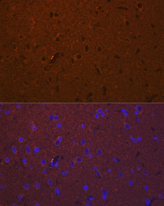 Immunofluorescence analysis of Rat brain using DCAMKL1/DCLK1 Polyclonal Antibody at dilution of 1:100 (40x lens). Blue: DAPI for nuclear staining.