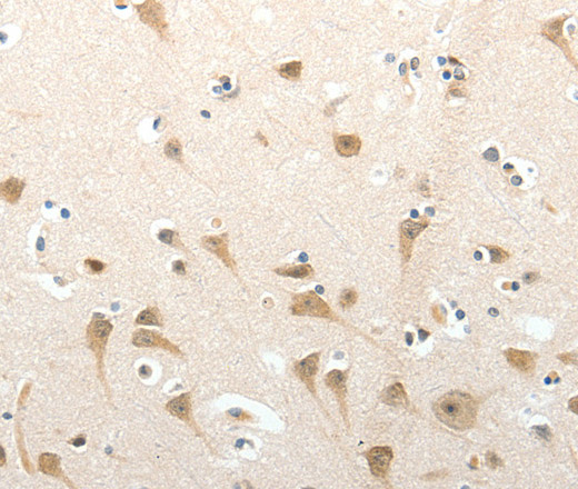 Immunohistochemistry of paraffin-embedded Human brain tissue using SEMA3D Polyclonal Antibody at dilution 1:50