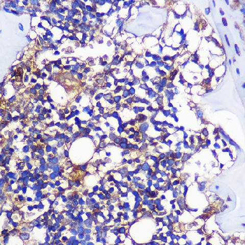 Immunohistochemistry of paraffin-embedded Rat leg bone using CCR1 Polyclonal Antibody at dilution of 1:100 (40x lens).Perform microwave antigen retrieval with 10 mM PBS buffer pH 7.2 before commencing with IHC staining protocol.