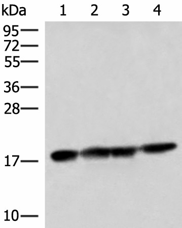 Western blot analysis of 293T HepG2 and Mouse liver tissue lysates  using PEMT Polyclonal Antibody at dilution of 1:800