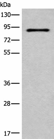 Western blot analysis of HUVEC cell lysate  using C7 Polyclonal Antibody at dilution of 1:800