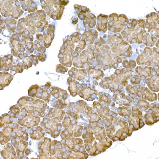 Immunohistochemistry of paraffin-embedded rat pancreas using IRE1 Polyclonal Antibody at dilution of 1:100 (40x lens).Perform high pressure antigen retriev