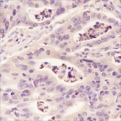 Recombinant ALDOA Monoclonal Antibody - 2