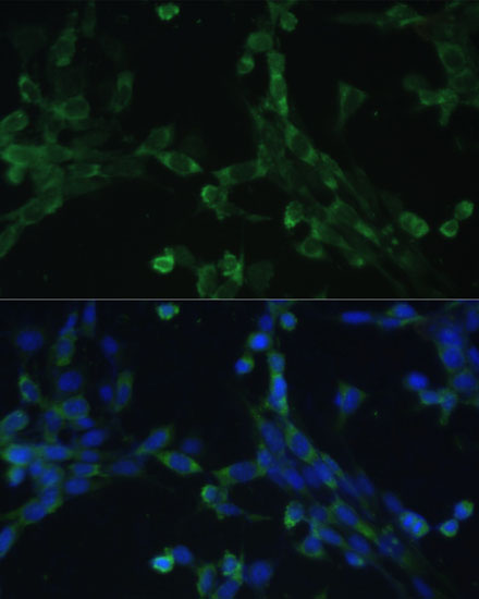 Immunofluorescence analysis of NIH-3T3 cells using EEF1G Polyclonal Antibody at dilution of  1:100 (40x lens). Blue: DAPI for nuclear staining.