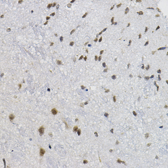 Immunohistochemistry of paraffin-embedded mouse spinal cord using DNAJC17 Polyclonal Antibody at dilution of 1:20 (40x lens).Perform high pressure antigen retrieval with 10 mM citrate buffer pH 6.0 before commencing with IHC staining protocol.