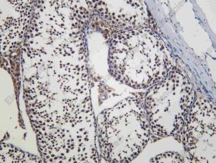 Recombinant YTHDC1 Monoclonal Antibody - 1
