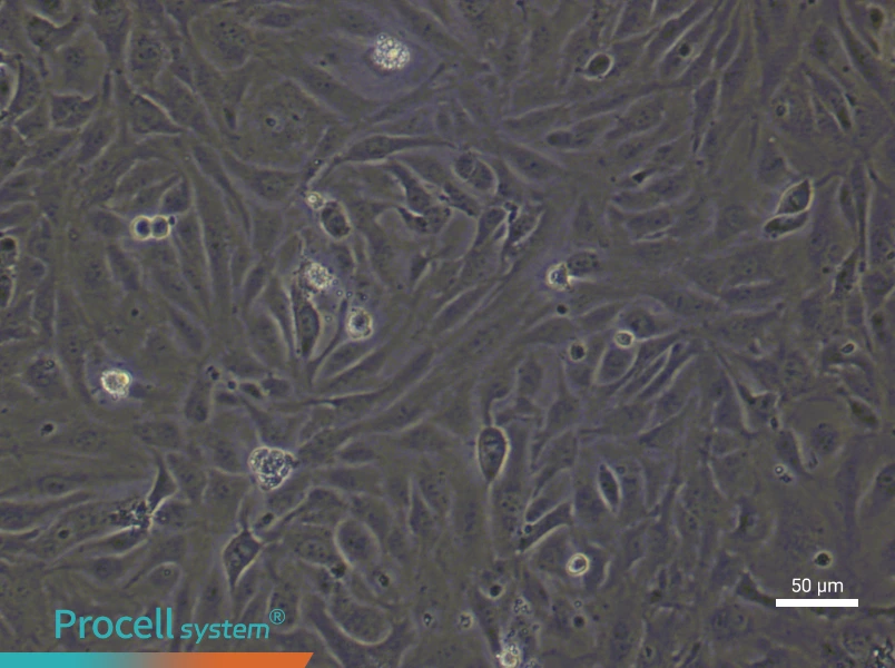 Human Lymphatic Endothelial (Primary cell immortalization) Cell Complete Medium - 6