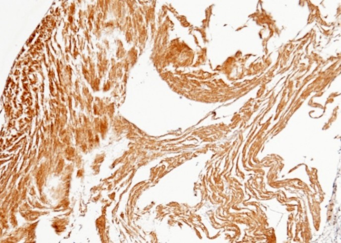 Recombinant PPM1G Monoclonal Antibody - small - 2