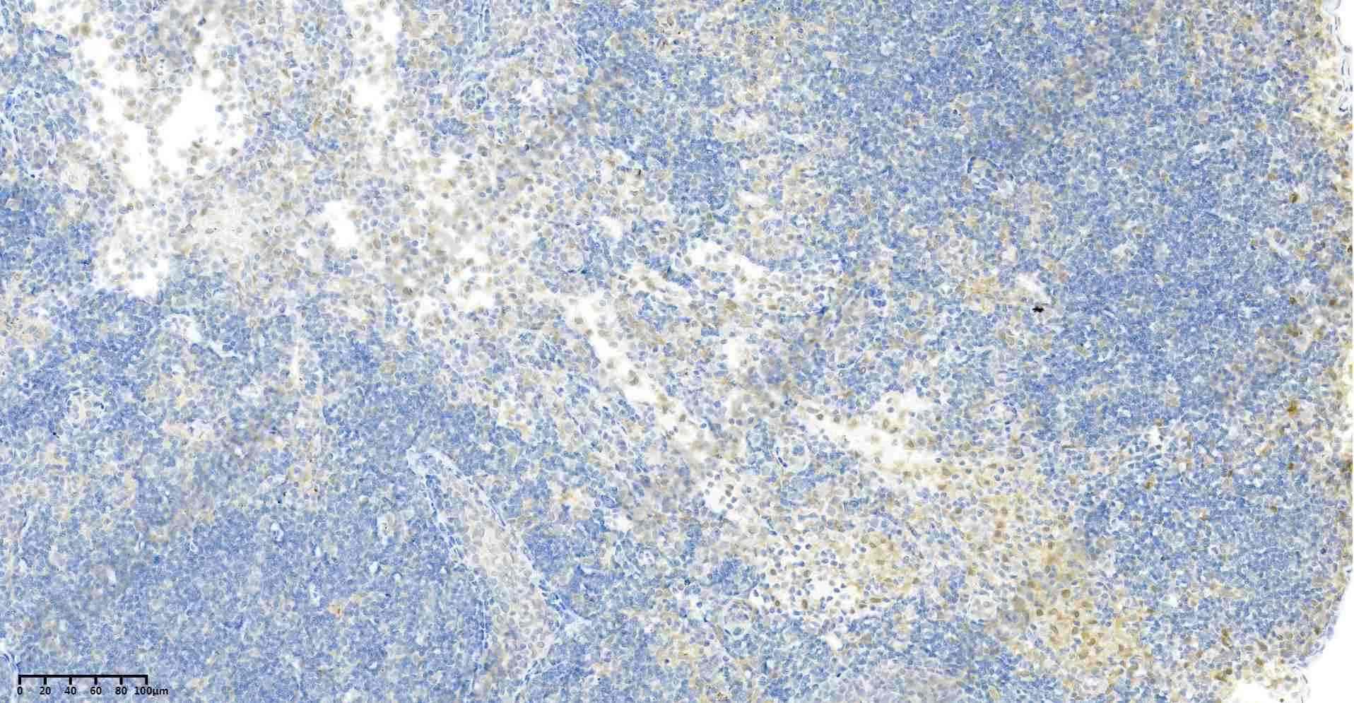 Recombinant p38 Monoclonal Antibody - 3