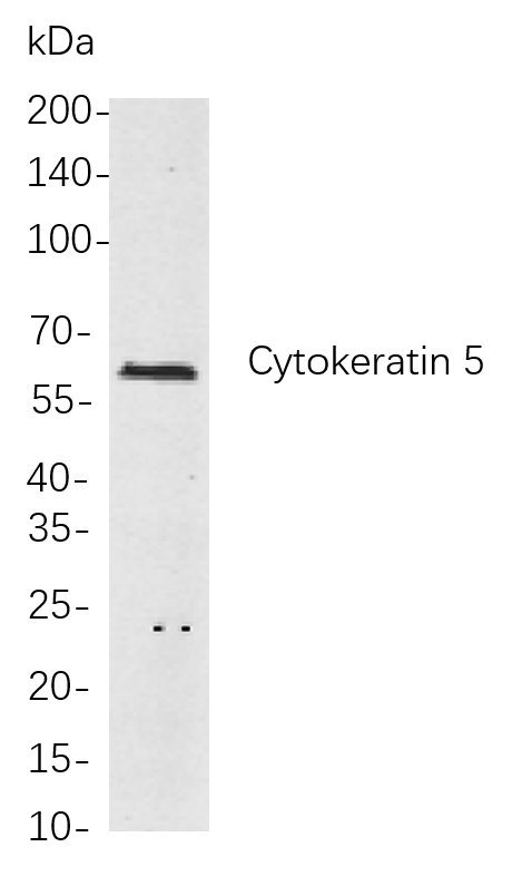 Recombinant Cytokeratin 5 Monoclonal Antibody-searchlist-1
