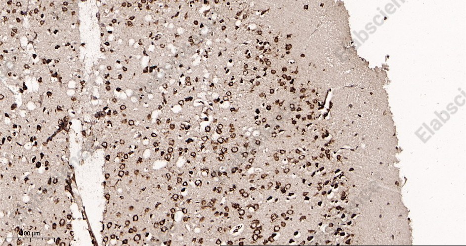 Recombinant YTHDF1 Monoclonal Antibody - 3