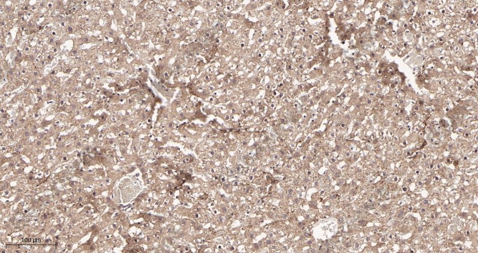Recombinant LAMP1 Monoclonal Antibody - 3