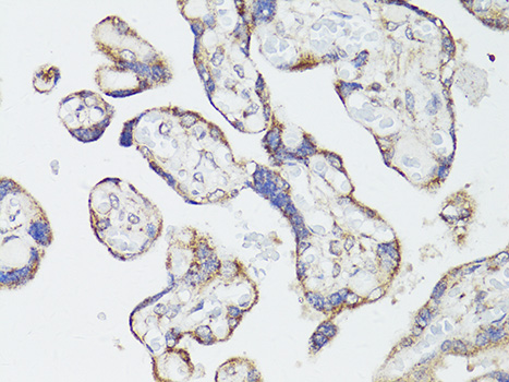 Immunohistochemistry of paraffin-embedded Human placenta using mTOR Polyclonal Antibody at dilution of 1:150 (40x lens).