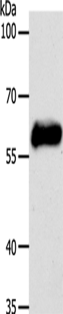 Western Blot analysis of MCF7 cell using CK-10 Polyclonal Antibody at dilution of 1:750