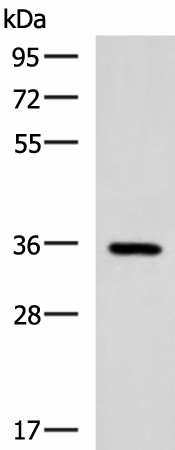 Western blot analysis of Mouse brain tissue lysate  using B3GAT1 Polyclonal Antibody at dilution of 1:650