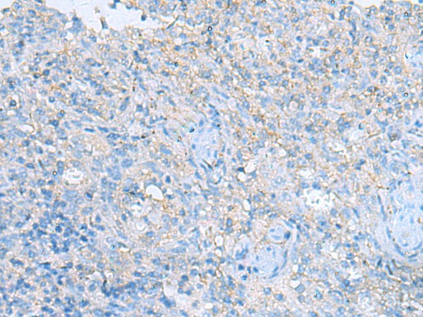 Immunohistochemistry of paraffin-embedded Human tonsil tissue  using HRAS Polyclonal Antibody at dilution of 1:25(?200)