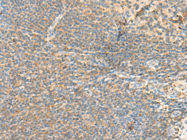 Immunohistochemistry of paraffin-embedded Human tonsil tissue  using RHOH Polyclonal Antibody at dilution of 1:90(?200)