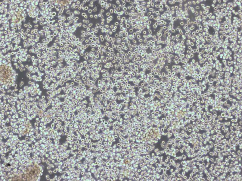 KHYG-1 Cell Complete Medium-searchlist-1