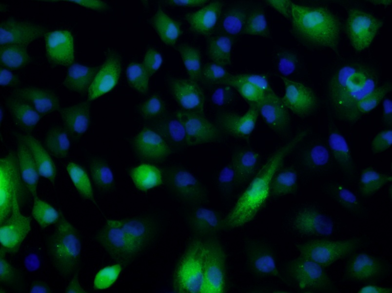 ACHN-GFP Cell Complete Medium - 4