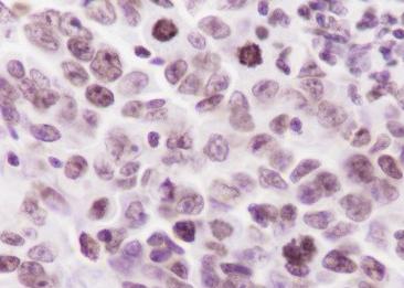 Recombinant Histone H3 (Mono Methyl Lys36) Monoclonal Antibody-searchlist-3