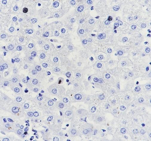 Recombinant SLC45A3 Monoclonal Antibody - small - 4