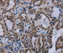 HMGB1 Polyclonal Antibody - 2