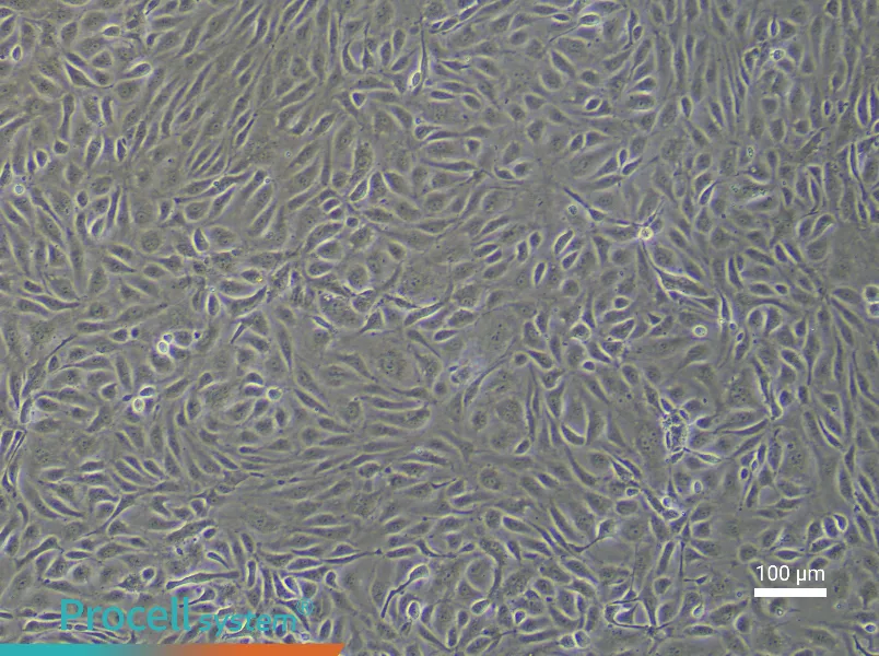 Human Pulmonary Great Vein Endothelial Cell Complete Medium - 1