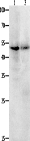 Western Blot analysis of Jurkat cell and Human ovarian cancer tissue using KLF5 Polyclonal Antibody at dilution of 1:1700
