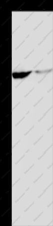 KCNK9 Polyclonal Antibody - 1