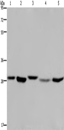 Western Blot analysis of 293T, MCF-7 and PC3 cell, Human fetal liver tissue and Hela cell using ECHS1 Polyclonal Antibody at dilution of 1:300