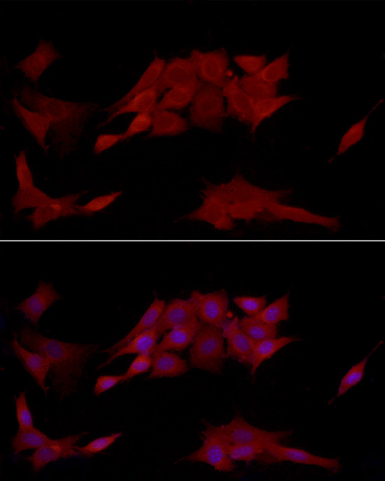 Immunofluorescence analysis of NIH/3T3 cells using [KO Validated] PTPN2 Polyclonal antibody at dilution of 1:250 (40x lens). Blue: DAPI for nuclear staining.