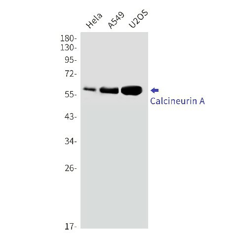 Western blot detection of Calcineurin A in Hela,A549,U2OS cell lysates using Calcineurin A Rabbit mAb(1:1000 diluted).Predicted band size:59kDa.Observed band size:59kDa.