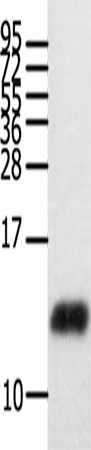 Western Blot analysis of Human brain glioma tissue  using CCL28 Polyclonal Antibody at dilution of 1:450