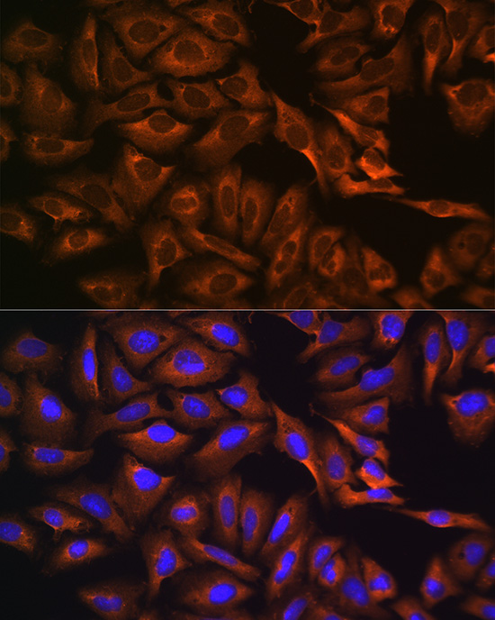 Immunofluorescence analysis of U-2 OS cells using CAPRIN1 Polyclonal antibody at dilution of 1:100 (40x lens). Blue: DAPI for nuclear staining.