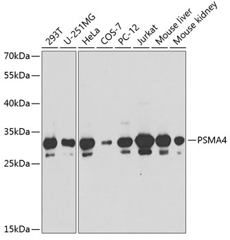 Western blot analysis of extracts of various cell lines using PSMA4 Polyclonal Antibody at 1:1000 dilution.