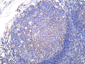Recombinant PLAUR Monoclonal Antibody - 1